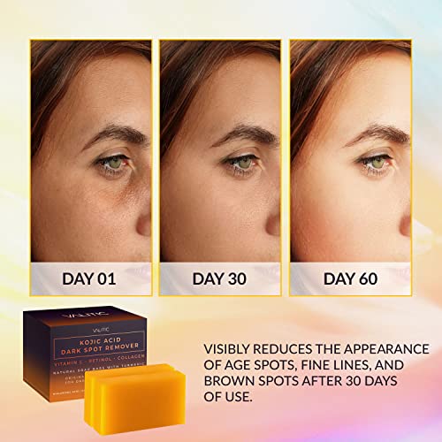 Sabonete Clareador de Manchas Escuras com Ácido Kójico, Vitamina C, Retinol, Colágeno, Cúrcuma – Complexo Japonês Original Infundido com Ácido Hialurônico, Vitamina E, Manteiga de Karité – 100g - VALITIC