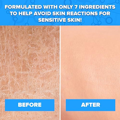 Aquanil - Person: Creme Facial Hidratante 50g  Exclusiva