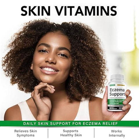 Greenford - Tratamento para Eczema: Creme Natural para Alívio Imediato – 50g