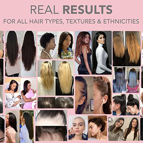 MOM Vegan Prenatal – Fórmula Vegana para Cabelos Saudáveis durante a Gravidez – 60 Cápsulas - HAIRtamin