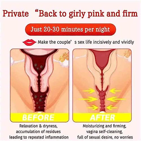 Dmqwhtj - Cápsulas Naturais de Reparo Vaginal, Parador Instantâneo de Coceira – Marca: Natural Repair