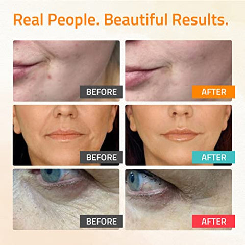 Serum Retinol para o Rosto, Serum Vitamina C para o Rosto com Ácido Hialurônico, Serum Retinol para o Rosto, Serum Vitamina C para o Rosto Mulheres, Kit Cuidados com a Pele 3×30 ml - YEOUTH