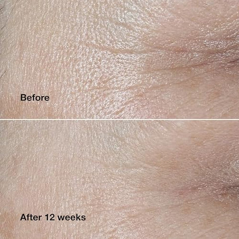 Clinique Smart Clinical Creme Facial Reparador de Rugas – Fórmula Inteligente – 50g