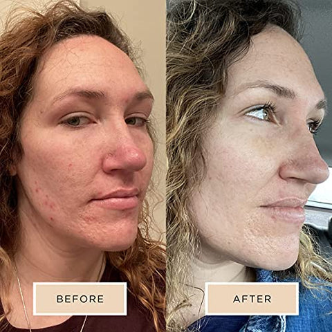 Néctar de Limpeza Radiante No.2 – Lava Rosto Diário Anti-Envelhecimento sem Enxágue – Combate Acne, Espinhas, Cravos - Averr Aglow