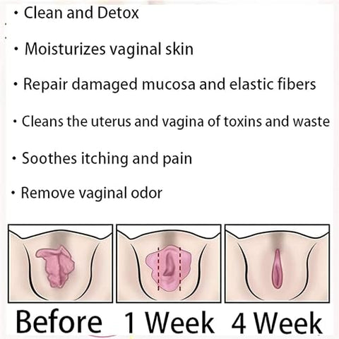 EXGYAN - Annie Care Cápsulas Rosa e Delicadas, Fique com a Pele Limpa