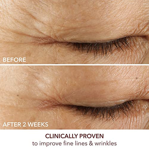 Dr Dennis Gross - Dr. Dennis Gross Advanced Retinol Ferulic Triple Correction Eye Serum | Firmeza da Pele, Hidratação Intensiva e Redução de Rugas  Dr. Dennis Gross