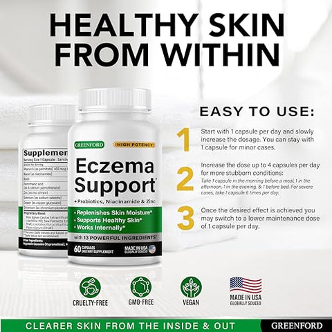 Greenford - Tratamento para Eczema: Creme Natural para Alívio Imediato – 50g