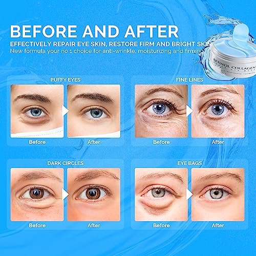 Patches para Olheiras: 30 Pares Máscara de Gel para Olhos com Retinol e Colágeno – Reduz Rugas e Inchaço - Enaskin Naturals