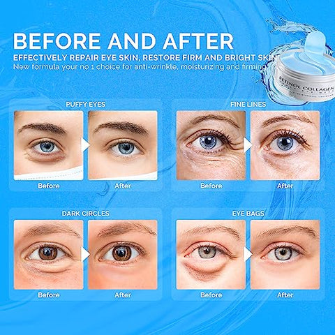 Patches para Olheiras: 30 Pares Máscara de Gel para Olhos com Retinol e Colágeno – Reduz Rugas e Inchaço - Enaskin Naturals
