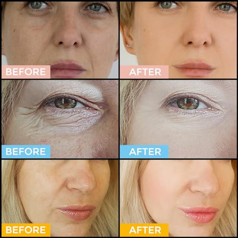 1HEROLABS - Conjunto de Serum Facial – Serum de Retinol, Vitamina C