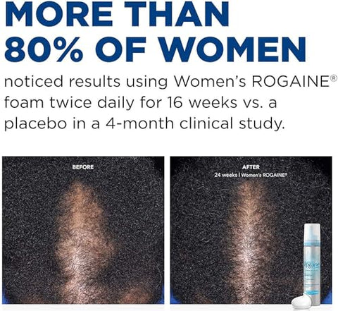 Espuma Minoxidil 5%% Tratamento Diário Queda de Cabelo Feminino 2 Meses 60g - Rogaine