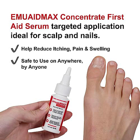 emuaid - EmuaidMAX Concentrado Soro de Primeiros Socorros 30ml para Psoríase, Eczema, Fungos nas Unhas, Foliculite e Dermatite Seborreica
