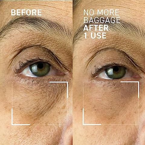 Dr. Brandt Skincare - Dr. Brandt Needles No More Gel Desinchador para Olhos 15g / 0.5oz