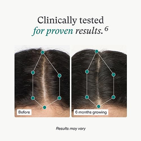 Mulheres 18-44 Anos – Cabelo Mais Forte e Espesso – Recomendado por Dermatologistas – 1 Mês – 60 Cápsulas - Nutrafol