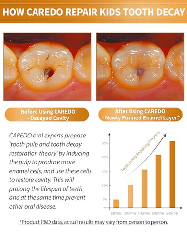 CAREDO - Creme Dental Infantil de Hidroxiapatita para Reverter Cáries, Reparo de Cáries em Casa sem Flúor, Seguro para Crianças – Marca: Kids Hydroxyapatite