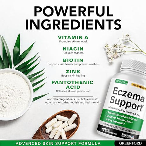 Greenford - Tratamento para Eczema: Creme Natural para Alívio Imediato – 50g
