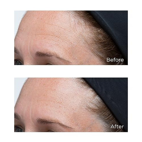Perricone MD: Hidratante Intensivo de Ácido Hialurônico 30ml (Embalagem de 1 unidade)