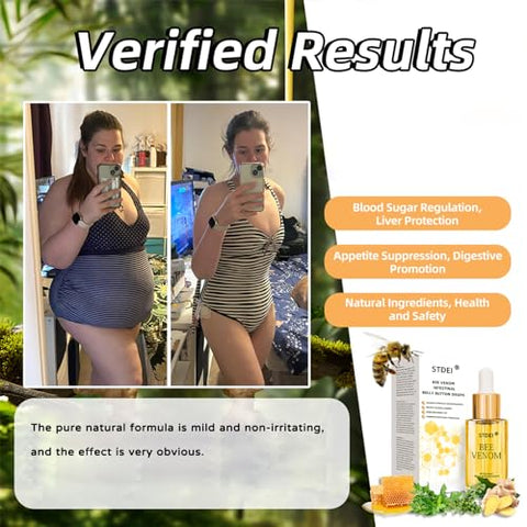 dooeka - STDEI Bee Venom Detox Intestinal – Gotas para o Umbigo – Extratos Naturais Puros – Todos os Gêneros e Idades (2 Frascos)