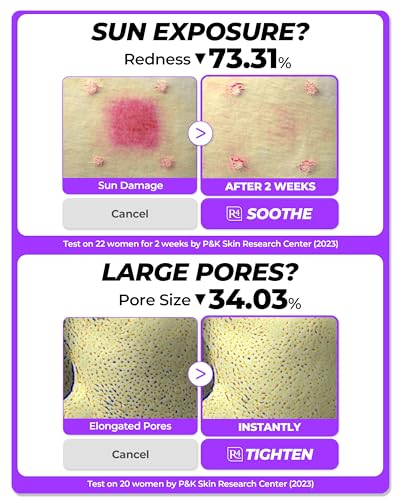 Dermafirm - [DERMAFIRM] Sérum Reparador Calmante R4 | Sérum Facial de Bakuchiol com Niacinamida | 30ml