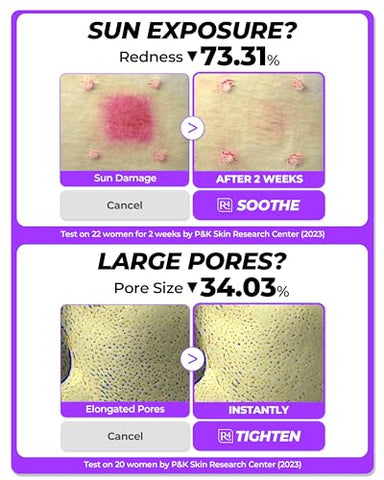 Dermafirm - [DERMAFIRM] Sérum Reparador Calmante R4 | Sérum Facial de Bakuchiol com Niacinamida | 30ml