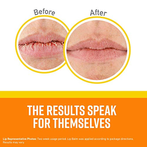 O'Keeffe's - O’Keeffe’s Lip Repair Bálsamo Labial SPF 35, Pack com 3 – Proteção Solar e Hidratação Intensa