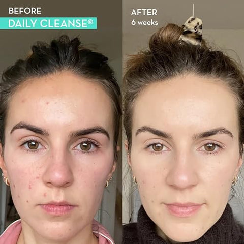 Full Skin and Liver Detox: Wingman e Daily Cleanse – Desintoxicação Verde de Cardo de Leite para saúde da pele e do fígado - HUM