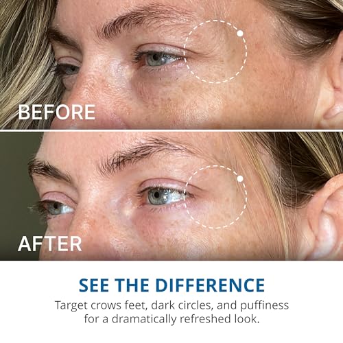 Creme Reparador Avançado para os Olhos – Creme para Olheiras, Bolsas e Inchaço, Melhora Visivelmente a Aparência de Linhas Finas, Rugas e Pés de Galinha – 16,9 ml - goPure