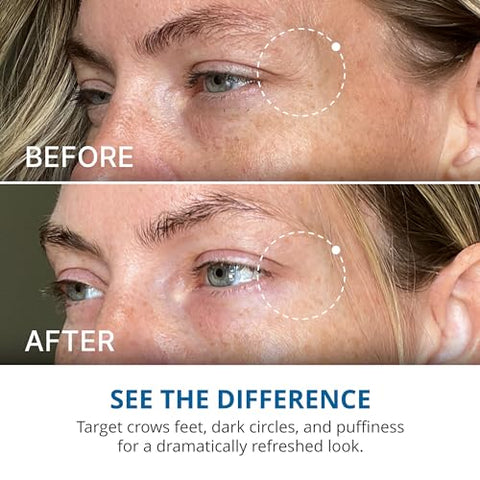 Creme Reparador Avançado para os Olhos – Creme para Olheiras, Bolsas e Inchaço, Melhora Visivelmente a Aparência de Linhas Finas, Rugas e Pés de Galinha – 16,9 ml - goPure