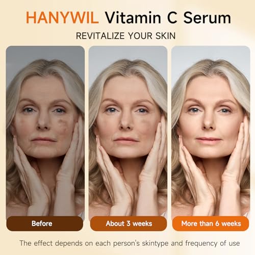 HANYWIL - Sérum Facial Super Vitamina C, Com Ingredientes Naturais para Manchas de Idade, Rugas, Hidratação, Cuidados Anti-Envelhecimento, Firmeza, Levanta, Suaviza, Vitamina C Sérum Facial 90 ml
