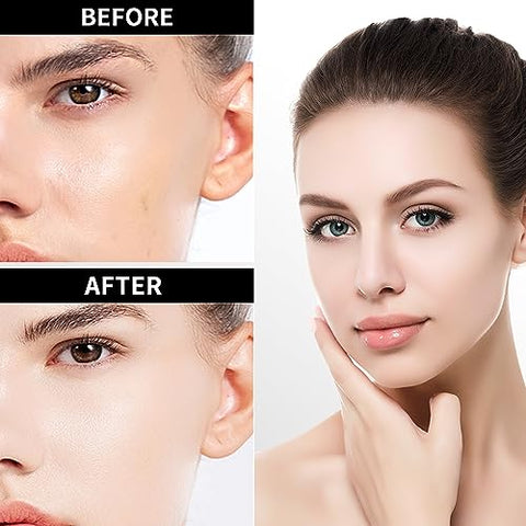 Serum Facial Vitamina C Vitamina E, 30ml / 1.01oz – Marca VGO - VGO