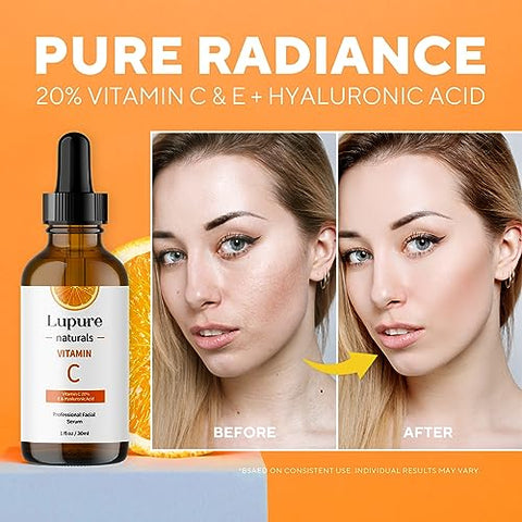 Lupure - Sérum Facial Profissional de Vitamina C 20%, Super Vit C Anti-Envelhecimento com Ácido Hialurônico