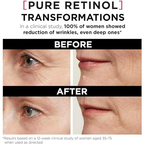 L'Oreal Paris - L’Oréal Paris Revitalift Triple Power LZR Serum Noturno para o Rosto, com 0,3% de Retinol Puro, Hidrata a Pele e Elimina Rugas Profundas, para Todos os Tipos de Pele, 30ml
