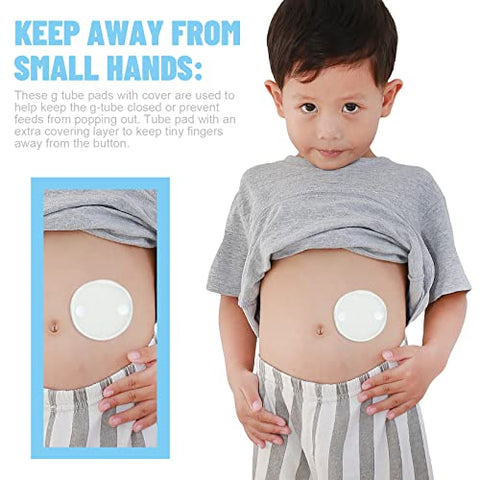 20 Pack Almofadas para Tubo de Alimentação G Button com Capa – Suprimentos Reutilizáveis para Tubo de Alimentação Gtube – Coberturas de Algodão para Botão G – Suprimentos para Diálise Abdominal Peritoneal e Tubo Peg - Sosation