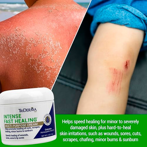 Creme Intenso de Cicatrização Rápida, Reduz Tempo de Cicatrização para Irritações Leves, Erupções Cutâneas, Arranhões, Cortes 4g - TriDerma