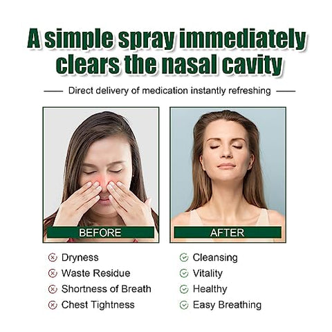 BITYEYE - Spray Herbal Respinature para Limpeza Pulmonar – Suporte Poderoso para os Pulmões – 30ml (10PCS)