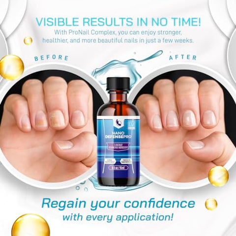 LIVORKA - Nano Defense Pro – 2 Frascos para 60 Dias – Gota, Líquido, Solução – Defesa Avançada – Nanotecnologia – Proteção Total – Resultados Garantidos