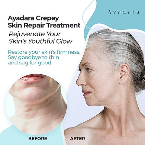 AYADARA - Tratamento Reparador para Pele Enrugada 240ml, Loção Firmadora para Pele Flácida, Creme Corretor de Rugas e Colágeno para Reafirmar a Pele do Corpo, Creme Anti-Rugas para Rosto, Pescoço, Braços e Pernas, 500 Utilizações