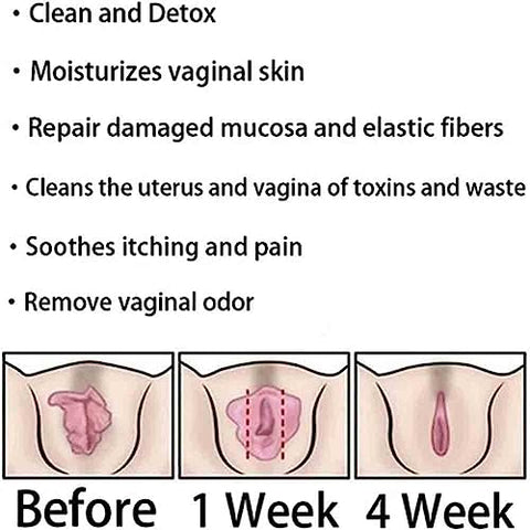 Dmqwhtj - Cápsulas Naturais de Reparo Vaginal, Parador Instantâneo de Coceira – Marca: Natural Repair