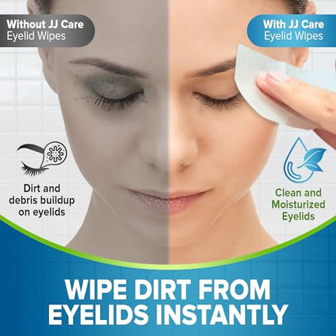 Lenços de Limpeza para Pálpebras 160 Unidades, Lenços Individuais para Limpeza das Pálpebras, Lenços Hidratantes para Olhos Irritados, Coceira e Secos, Lenços Hipoalergênicos para Limpeza dos Olhos - JJ CARE