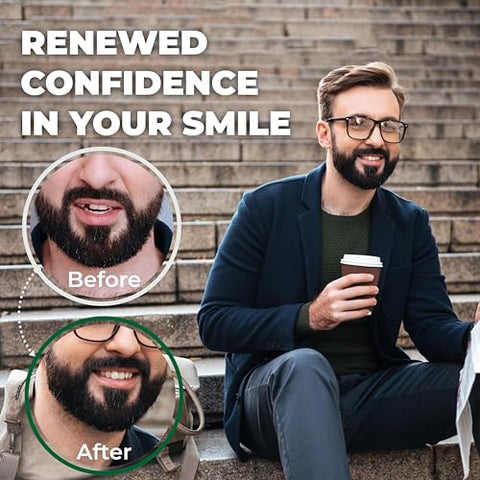 Amazing Temporary Tooth - Kit de Substituição Temporária de Dentes (Sombra Natural) – Reparo de Dentes Ausentes Temporários, Disponível em Sombra Natural ou Brilhante