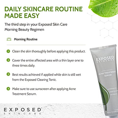 Tratamento para Acne – Serum Passo 3 Reduz Rapidamente o Tamanho e Vermelhidão das Espinhas – Tratamento Localizado de 12 Horas – 3.5% Peróxido de Benzoíla, Chá Verde Natural - Exposed Skin Care