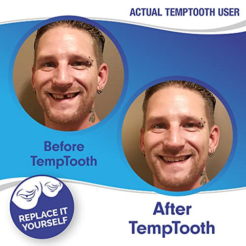 Produto Patenteado de Substituição Temporária de Dente, Confiança do Número 1 em Vendas - Temptooth