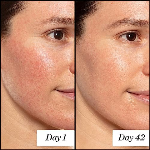 Sunday Riley Serum Retinol Anti-Envelhecimento de Alta Potência – 30ml