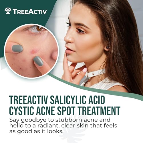 Tratamento para Acne Cística TreeActiv – Ácido Salicílico, Creme para Acne Facial, Tratamento para Acne Hormonal, Creme para Acne Facial e Corporal, Tratamento para Manchas de Acne