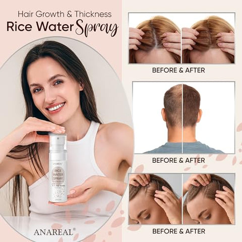 ANAREAL - Água de Arroz para Crescimento Capilar – Sérum Spray 200ml para Mulheres – Marca BrandName