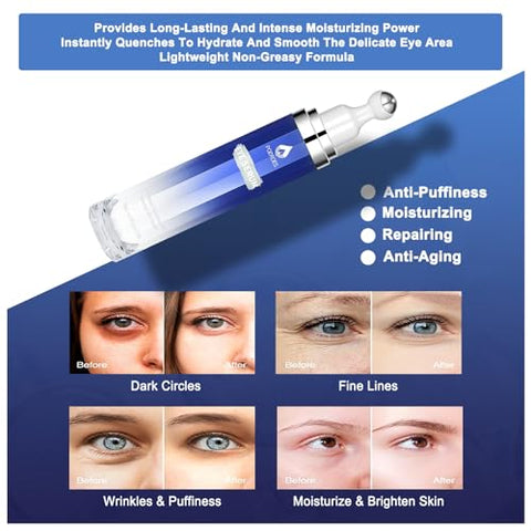 POEROES - Sérum para os Olhos com 8% de Cafeína, 8% de Retinol, Ácido Hialurônico, Niacinamida e Peptídeos para Bolsas nos Olhos, Linhas Finas, Olheiras e Rugas – Creme para os Olhos com Massageador 360°