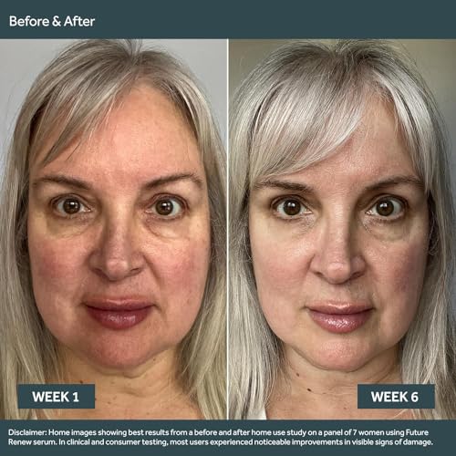 Conjunto de Cuidados com a Pele No7 Future Renew Damage Reversal – Sérum Facial Anti-Envelhecimento (10 ml), Creme Diurno com FPS 25 (50 ml)