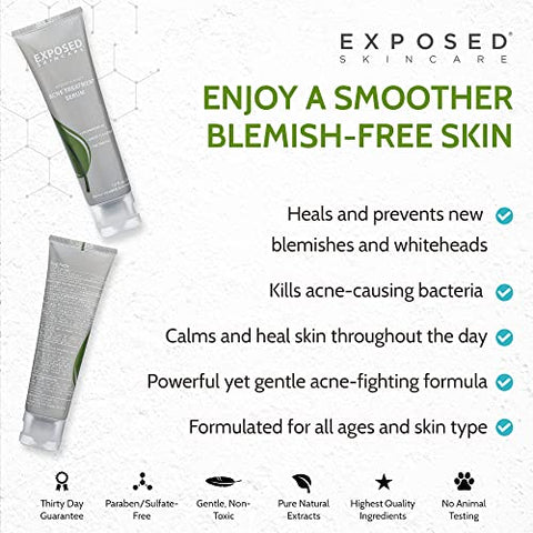 Tratamento para Acne – Serum Passo 3 Reduz Rapidamente o Tamanho e Vermelhidão das Espinhas – Tratamento Localizado de 12 Horas – 3.5% Peróxido de Benzoíla, Chá Verde Natural - Exposed Skin Care