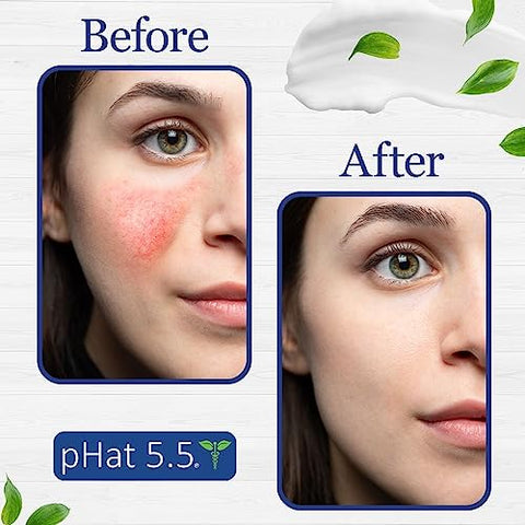 pHat 5.5 - Creme Corporal Hidratante 200g  X: Hidratação Profunda para uma Pele Radiante