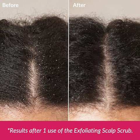 Love Ur Curls - LUS (Love Ur Self) Esfoliante para o Couro Cabeludo – Esfoliantes Naturais  LUS
